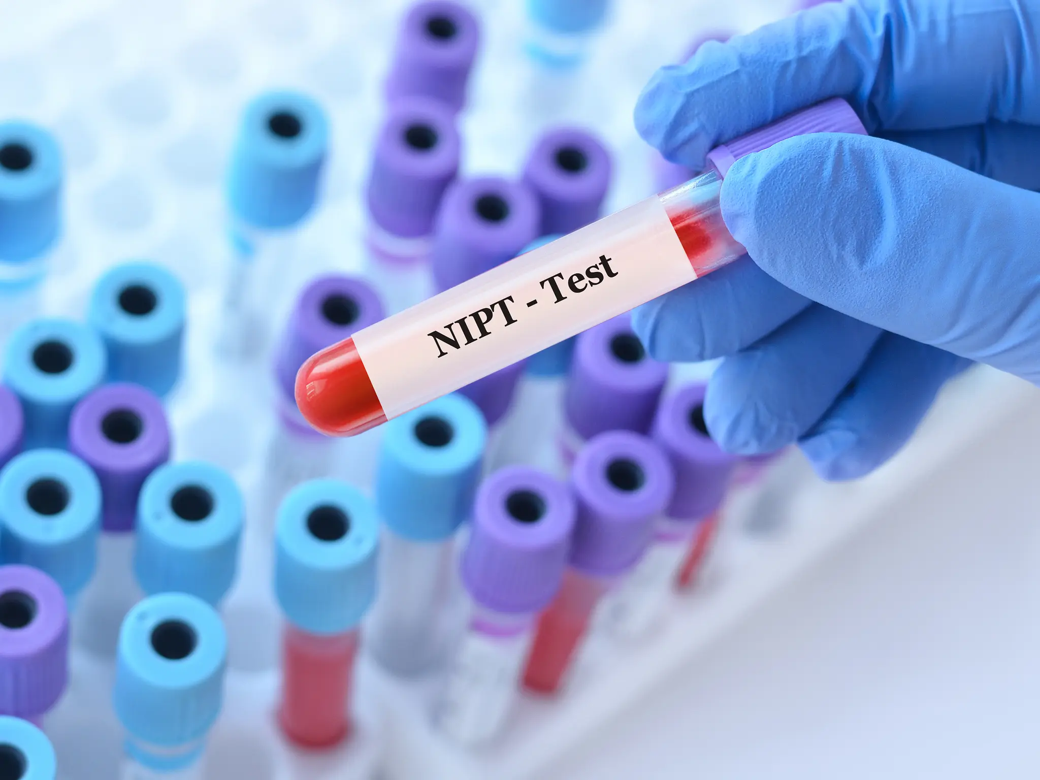 NIPT Testi