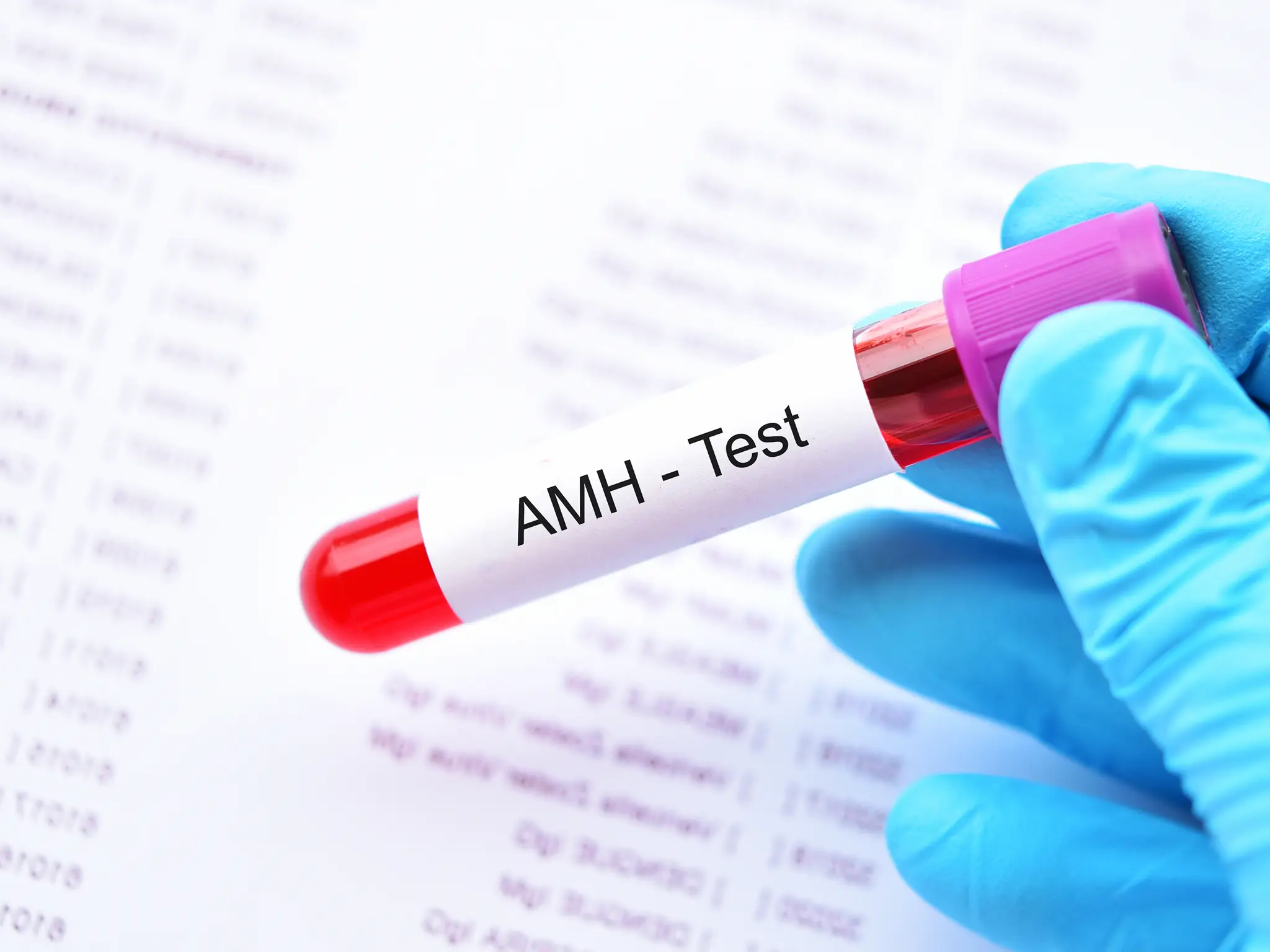 AMH Testi